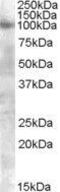 KGFR antibody, GTX88618, GeneTex, Western Blot image 