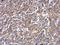 Cellular Communication Network Factor 2 antibody, GTX124232, GeneTex, Immunohistochemistry paraffin image 