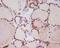 NK2 Homeobox 1 antibody, M01322-1, Boster Biological Technology, Immunohistochemistry paraffin image 