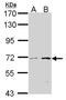 Carnitine O-Octanoyltransferase antibody, NBP1-31441, Novus Biologicals, Western Blot image 