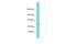 Neuroblastoma breakpoint family member 16 antibody, A18002, Boster Biological Technology, Western Blot image 