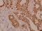 Protein Kinase C Zeta antibody, GTX66637, GeneTex, Immunohistochemistry paraffin image 