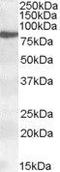 Arachidonate 15-Lipoxygenase antibody, GTX88501, GeneTex, Western Blot image 