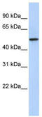 Na(+)/H(+) exchange regulatory cofactor NHE-RF3 antibody, TA346091, Origene, Western Blot image 