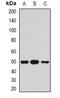 Serpin Family A Member 4 antibody, orb382030, Biorbyt, Western Blot image 