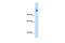 Carbamoyl-Phosphate Synthase 1 antibody, GTX46536, GeneTex, Western Blot image 