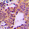 Cortactin antibody, LS-C353976, Lifespan Biosciences, Immunohistochemistry paraffin image 