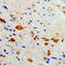 Protein Kinase CAMP-Activated Catalytic Subunit Beta antibody, LS-C352701, Lifespan Biosciences, Immunohistochemistry frozen image 