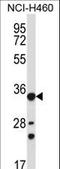 Aldo-Keto Reductase Family 1 Member B10 antibody, LS-C156210, Lifespan Biosciences, Western Blot image 