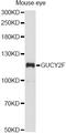 Guanylate Cyclase 2F, Retinal antibody, A10705, Boster Biological Technology, Western Blot image 