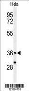 Sulfatase Modifying Factor 1 antibody, 64-212, ProSci, Western Blot image 