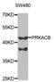 Protein Kinase CAMP-Activated Catalytic Subunit Beta antibody, abx004070, Abbexa, Western Blot image 