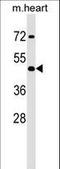 Homeobox A2 antibody, LS-C158202, Lifespan Biosciences, Western Blot image 