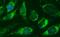 Centrosomal Protein 68 antibody, MA5-26304, Invitrogen Antibodies, Immunocytochemistry image 