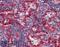 Major Histocompatibility Complex, Class I, E antibody, GTX79922, GeneTex, Immunohistochemistry paraffin image 