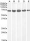 DEAD-Box Helicase 5 antibody, 45-470, ProSci, Enzyme Linked Immunosorbent Assay image 