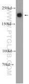 TSC Complex Subunit 2 antibody, 24601-1-AP, Proteintech Group, Western Blot image 