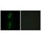 Activin A Receptor Like Type 1 antibody, A01468-1, Boster Biological Technology, Immunohistochemistry frozen image 