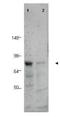 CCCTC-Binding Factor Like antibody, orb345528, Biorbyt, Western Blot image 