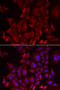 Pannexin 1 antibody, STJ28766, St John