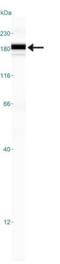 Low Density Lipoprotein Receptor antibody, NBP1-06709, Novus Biologicals, Western Blot image 