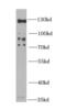 HIV-1 Tat Specific Factor 1 antibody, FNab04065, FineTest, Western Blot image 