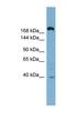 ATP Binding Cassette Subfamily C Member 11 antibody, NBP1-59810, Novus Biologicals, Western Blot image 
