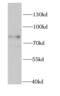 Methyl-CpG Binding Protein 2 antibody, FNab05082, FineTest, Western Blot image 