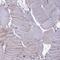 Interleukin 1 Receptor Associated Kinase 3 antibody, NBP1-83094, Novus Biologicals, Immunohistochemistry paraffin image 