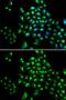RUNX Family Transcription Factor 1 antibody, GTX54704, GeneTex, Immunofluorescence image 