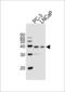 Vitamin D Receptor antibody, LS-C160512, Lifespan Biosciences, Western Blot image 
