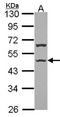 Major Histocompatibility Complex, Class II, DR Alpha antibody, orb74134, Biorbyt, Western Blot image 