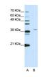 Spliceosome Associated Factor 3, U4/U6 Recycling Protein antibody, orb330039, Biorbyt, Western Blot image 