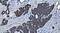 Mitogen-Activated Protein Kinase Kinase Kinase Kinase 5 antibody, A10186-1, Boster Biological Technology, Immunohistochemistry paraffin image 