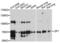 Zona Pellucida Glycoprotein 1 antibody, LS-C497482, Lifespan Biosciences, Western Blot image 