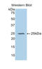 Glutathione Peroxidase 5 antibody, LS-C294244, Lifespan Biosciences, Western Blot image 
