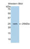 Glutathione peroxidase 5 antibody, LS-C294244, Lifespan Biosciences, Western Blot image 