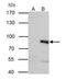 P21 (RAC1) Activated Kinase 6 antibody, PA5-28674, Invitrogen Antibodies, Immunoprecipitation image 