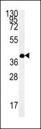 ER Membrane Protein Complex Subunit 3 antibody, LS-C161926, Lifespan Biosciences, Western Blot image 