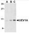 Transmembrane Protein 189 antibody, AP05250PU-N, Origene, Western Blot image 