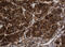 Asialoglycoprotein Receptor 2 antibody, M10123-1, Boster Biological Technology, Immunohistochemistry paraffin image 