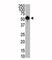 Lysine Methyltransferase 5A antibody, F40199-0.4ML, NSJ Bioreagents, Western Blot image 