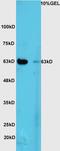 Siah E3 Ubiquitin Protein Ligase 1 antibody, orb6951, Biorbyt, Western Blot image 