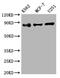 Inhibitor Of Nuclear Factor Kappa B Kinase Subunit Beta antibody, CSB-RA256500A0HU, Cusabio, Western Blot image 