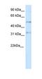 Potassium Voltage-Gated Channel Subfamily A Regulatory Beta Subunit 2 antibody, orb324736, Biorbyt, Western Blot image 