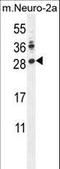 Lin-28 Homolog A antibody, LS-B11566, Lifespan Biosciences, Western Blot image 