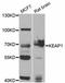 Kelch Like ECH Associated Protein 1 antibody, STJ113747, St John