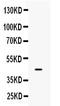 Interferon Regulatory Factor 9 antibody, A04485, Boster Biological Technology, Western Blot image 