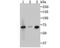 Interleukin 1 Receptor Associated Kinase 2 antibody, NBP2-76843, Novus Biologicals, Western Blot image 