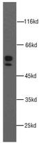 Matrix Metallopeptidase 1 antibody, FNab05233, FineTest, Western Blot image 